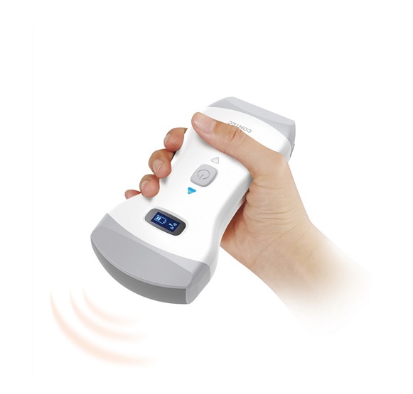 Portable Wireless Ultrasound CMS1600