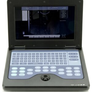 CMS600P2 Plus portable ultrasound machine