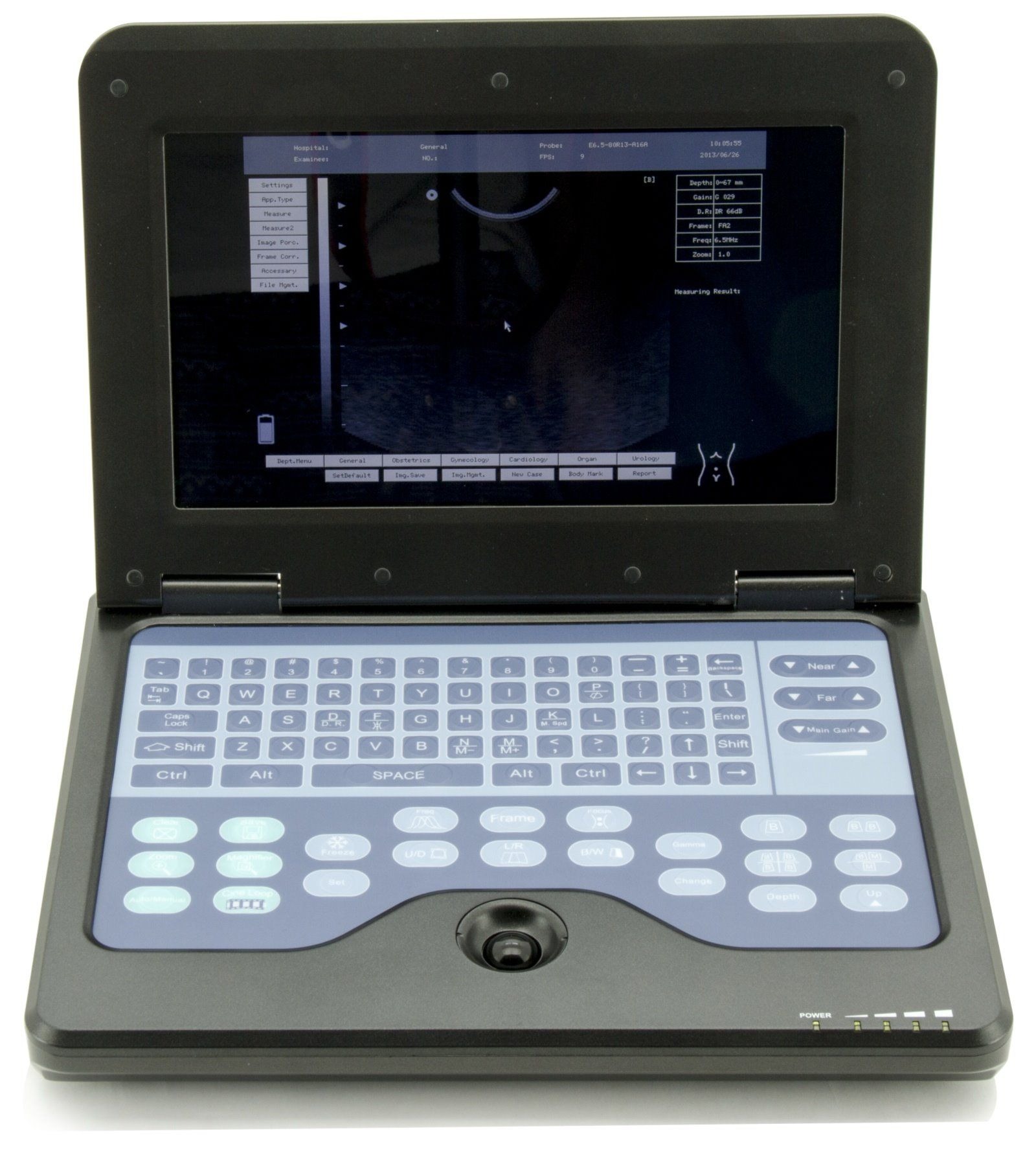 CMS600P2 Plus portable ultrasound machine