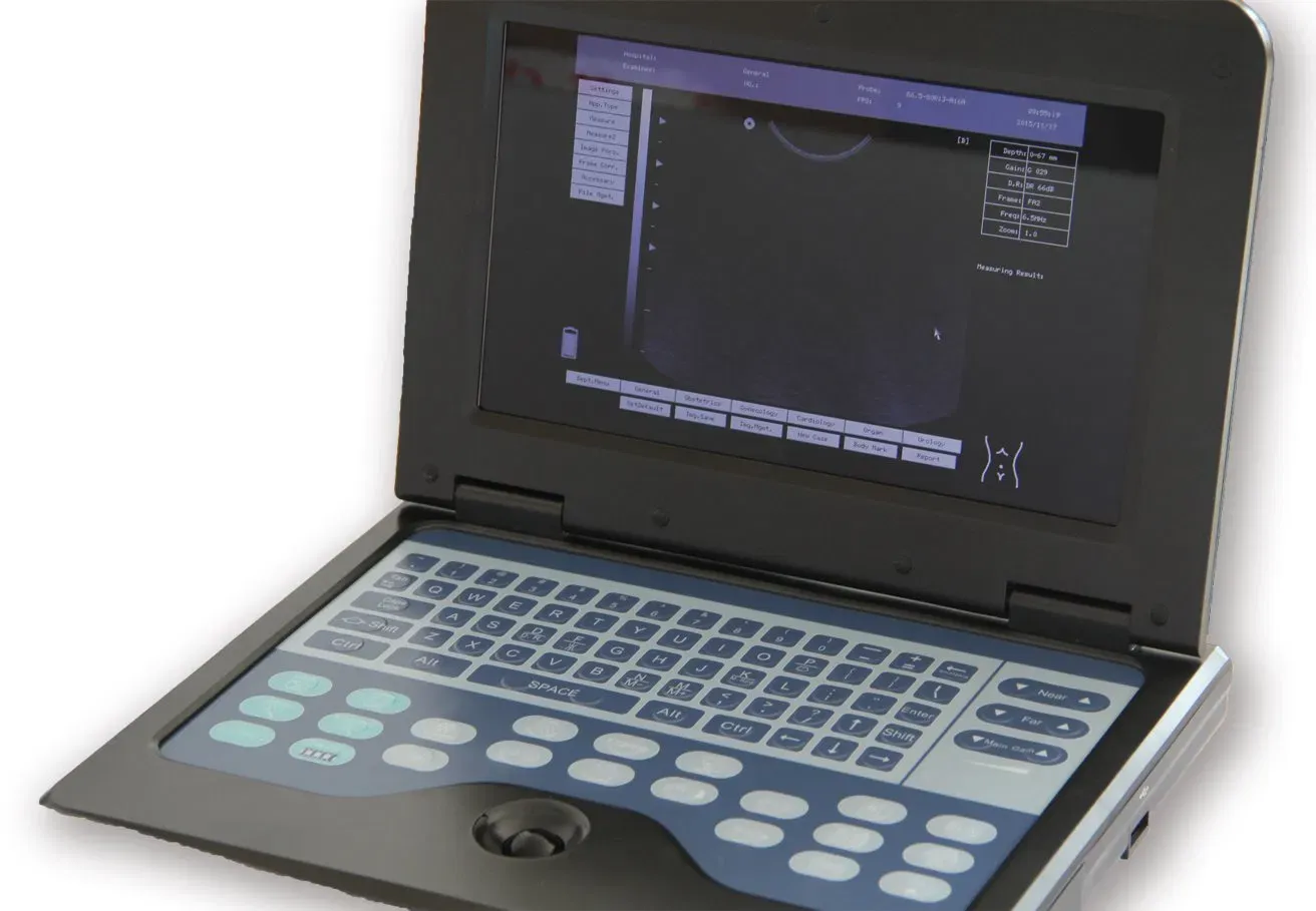 diagnostic ultrasound system with PW Doppler