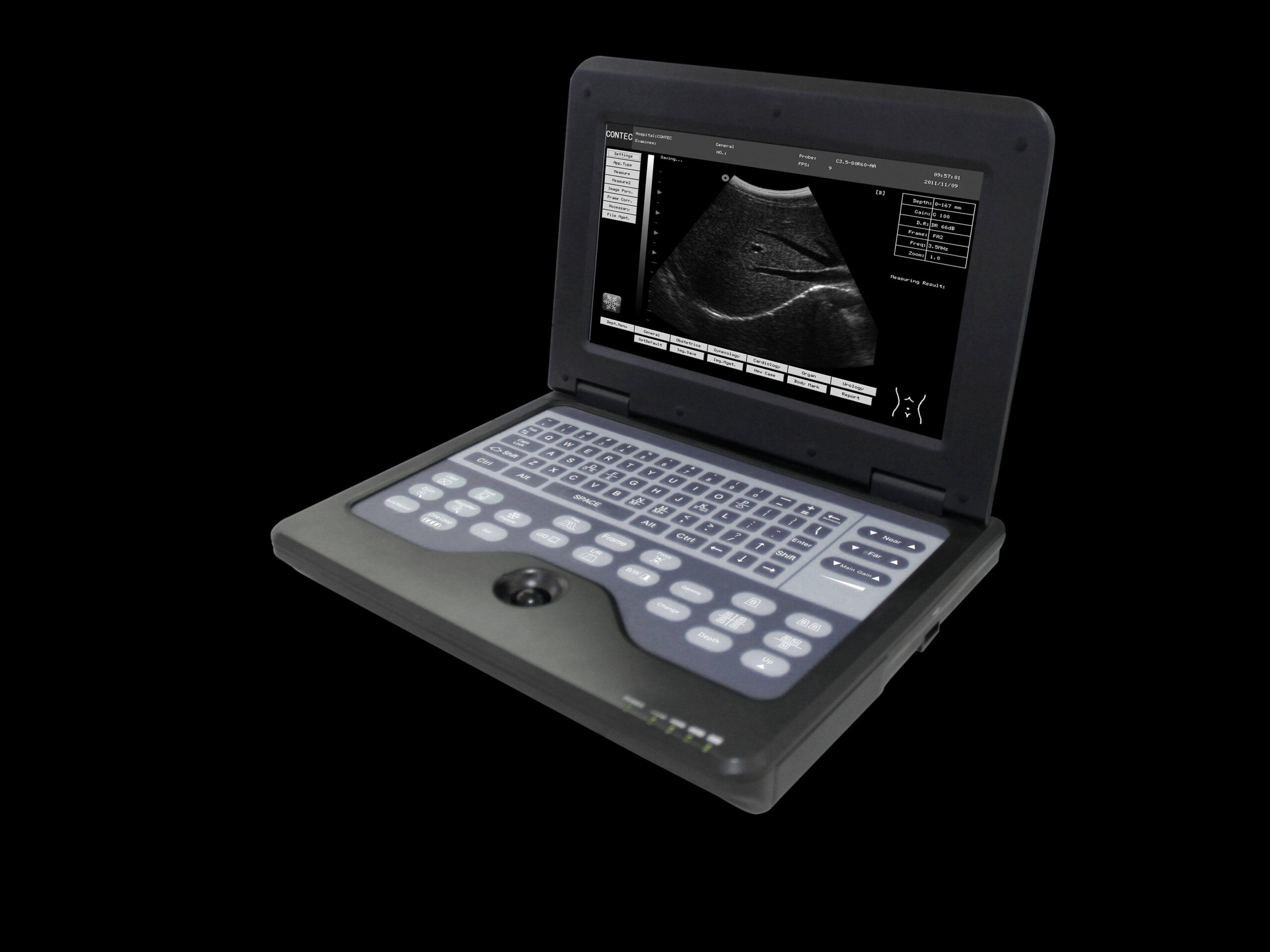medical ultrasound scanner for hospitals and clinics